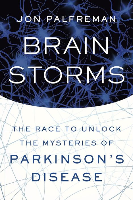 Cover of Braintstorms